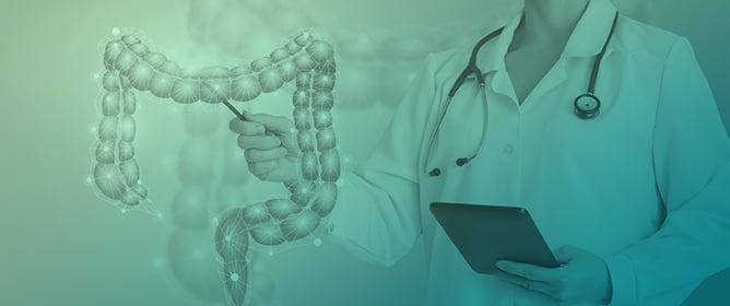 Calculated Immune Markers Are Good Predictors of Colorectal Cancer Survival