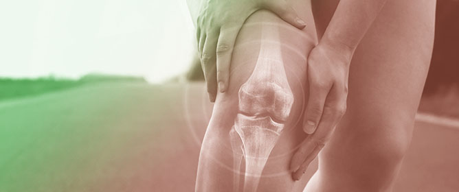 Development of a Clinical Guideline for Managing Knee Osteoarthritis in Portugal