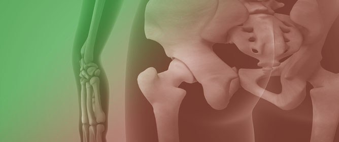 <em>Morganella morganii</em> Prosthetic Hip Infection