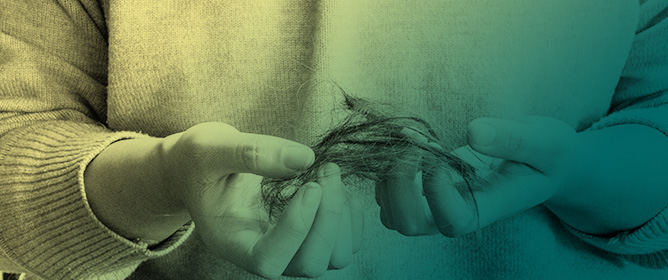 Advances in Transdermal Delivery Systems for Treating Androgenetic Alopecia