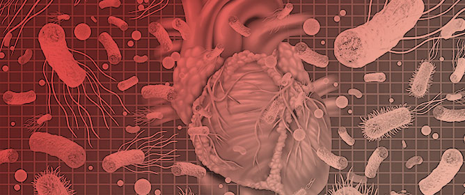 The Impact of Critical Illness on the Outcomes of Cardiac Surgery in Patients with Acute Infective Endocarditis