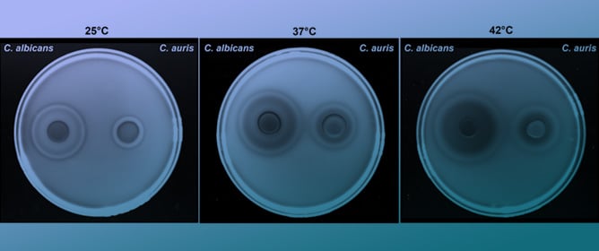 Biological Features, Antimicrobial Susceptibility and Phenotypic Characterization of <em>Candidozyma auris</em> CDC B11903 Grown at Different Temperatures