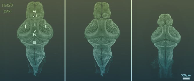 Investigating Psychopharmaceutical Effects on Early Vertebrate Development Using a Zebrafish Model System