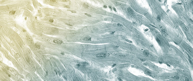 Biomarkers Characterizing the Onset of Dietary-Induced Hepatocellular Injury and Visceral Obesity in a Rat Experimental Model