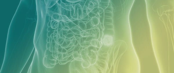 Adenoma-like Adenocarcinoma of the Colon: Case Report and Diagnostic Pitfalls of an Underrecognized Entity with Favorable Prognosis