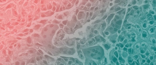 CRISPR-Mediated Analysis of p27 and PAK1 Phosphorylation Reveals Complex Regulation of Osteosarcoma Metastasis