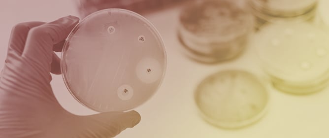 Evaluating Antimicrobial Susceptibility Testing Methods for Cefiderocol: A Review and Expert Opinion on Current Practices and Future Directions