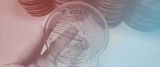 Greek Essential Oils Against Resistant <em>E. coli</em> and O157:H7