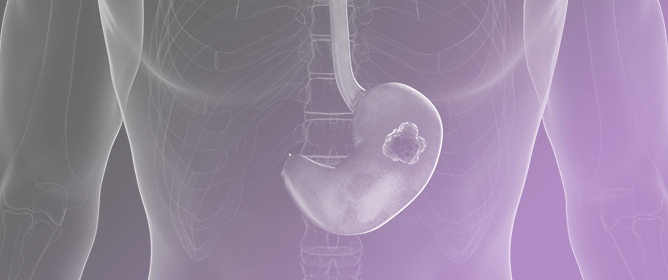 Higher NLR Values are Associated with Short-Term Mortality in Cirrhosis with Acute Variceal Bleeding