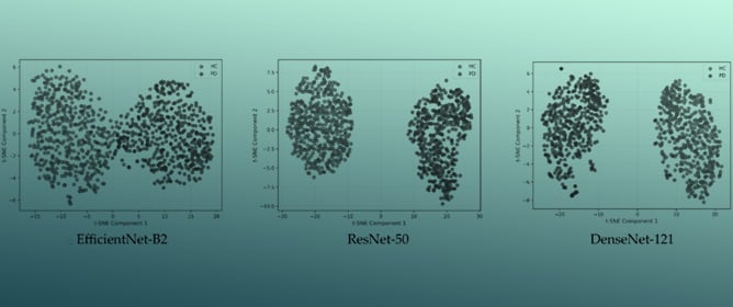 Multi-Channel Spectro-Temporal Representations for Parkinson’s Detection