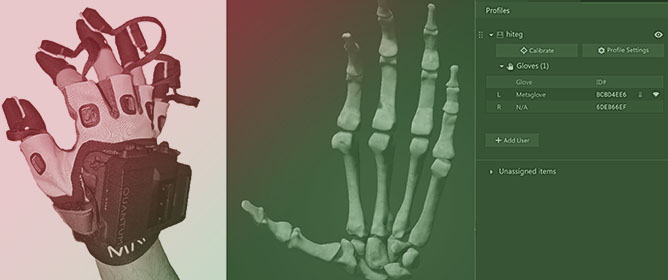 Geometric Algebra Approach to Hand Bradykinesia in Parkinson&rsquo;s Disease