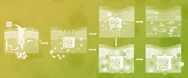 Immune Response to Extracellular Matrix Bioscaffolds: A Comprehensive Review