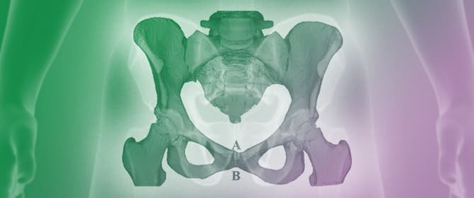 The Effects of Gut Volume and Parity on the Pubis