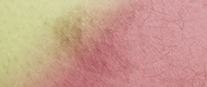 Agreement Document for the Study of Leishmaniasis from a One Health Approach in Spain