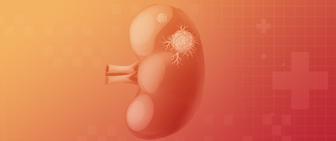 Renal Cell Carcinoma: Prognosis in the Era of Targeted Therapy