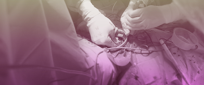 Addressing Complications in Cardiac Implantable Electronic Devices: A Guideline to Prevention of CIED Infection