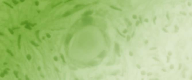 Short-Term In Vitro Culture of Human Ovarian Tissue: A Comparative Study of Serum Supplementation for Primordial Follicle Survival