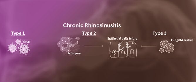 Clinical Significance of Endotypes of Asian Chronic Rhinosinusitis: A Review and Expert Commentary