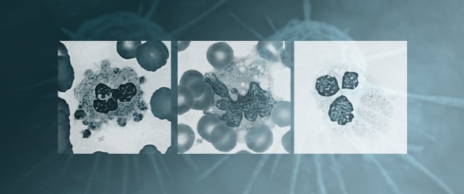 Gated Attention-Augmented Double U-Net for White Blood Cell Segmentation