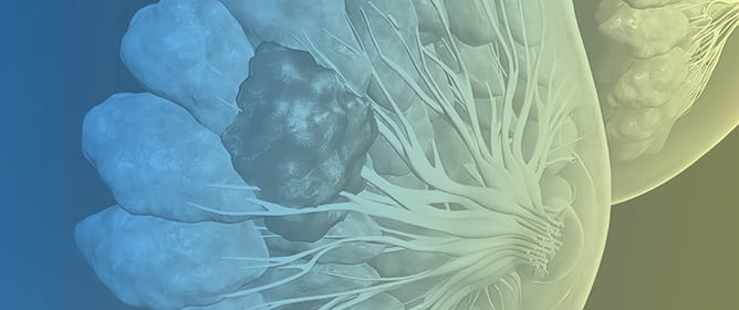 The Role of Immunotherapy and Radiation Therapy in the Treatment of Breast Cancer