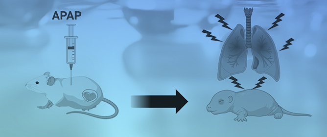 Developmentally Regulated CYP2E1 Expression Is Associated with a Fetal Pulmonary Transcriptional Response to Maternal Acetaminophen Exposure