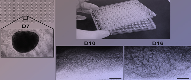 Parsing Glomerular and Tubular Structure Variability in High-Throughput Kidney Organoid Culture