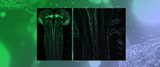 Neural Stem Cell Quiescence and Reactivation