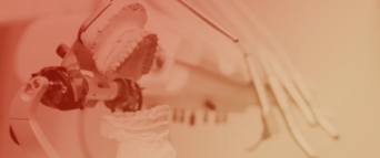 Marginal Gap Measurement of Pre-Cemented Metal&ndash;Ceramic Crowns: A Systematic Review