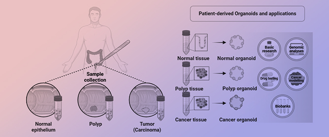 A Practical Guide for Developing Patient-Derived Colorectal Organoids