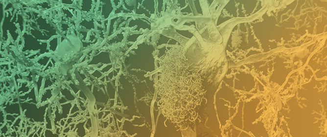 A Pilot Study: Sleep and Cognitive Effects of CPAP Intervention in Alzheimer's Disease with Obstructive Sleep Apnea