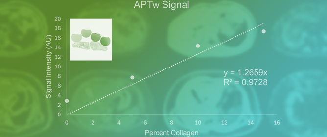 Feasibility of Sodium and Amide Proton Transfer-Weighted Magnetic Resonance Imaging Methods in Mild Steatotic Liver Disease