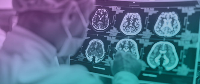 Neuroplasticity and Neuro-Generation: The Promise of Psychedelics in Dementia Care