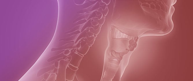 Exploring How Diabetes Relates to Head and Neck Cancer: An Umbrella Review Perspective