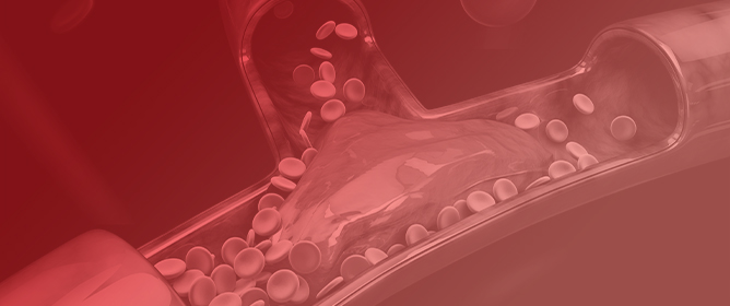 A Rare Case of First-Time Seizure Induced by Cerebral Venous Sinus Thrombosis Following the Use of Tranexamic Acid for Menorrhagia