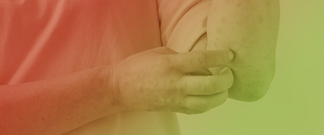 Different Levels of Endemicity of Cutaneous Leishmaniasis in Brazil