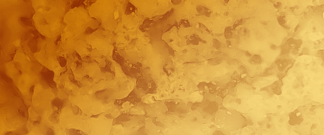 The Complex Life of Stone Heritage: Diagnostics and Metabarcoding on Mosaics from the Archaeological Park of Baia (Bacoli, Italy)