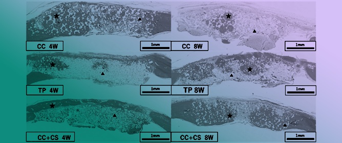 Comparative Evaluation of the Bone Regenerative Potential of a Novel Calcium Silicate-Modified Calcium Carbonate Graft Material: Histological and Micro-Computed Tomography Assessment Using a Rat Calvarial Defect Model