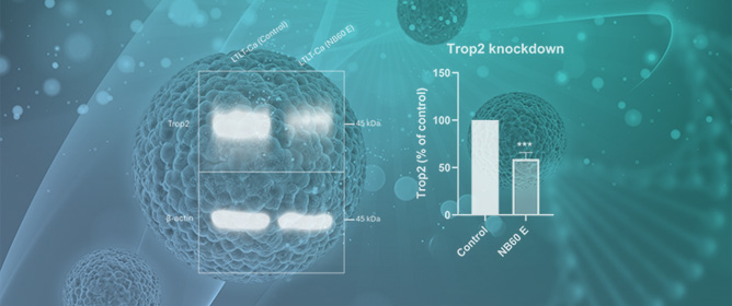 Engineered Nanobody-Bearing Extracellular Vesicles Enable Precision Trop2 Knockdown in Resistant Breast Cancer