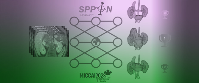 A Community Benchmark for the Automated Segmentation of Pediatric Neuroblastoma on Multi-Modal MRI: Design and Results of the SPPIN Challenge at MICCAI 2023
