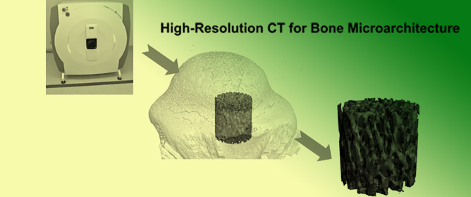Advancements in High-Resolution Computed Tomography: Revolutionising Bone Health Micro-Research