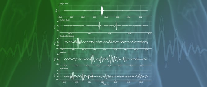 A Novel Unsupervised You Only Listen Once (YOLO) Machine Learning Platform for Automatic Detection and Characterization of Prominent Bowel Sounds Towards Precision Medicine