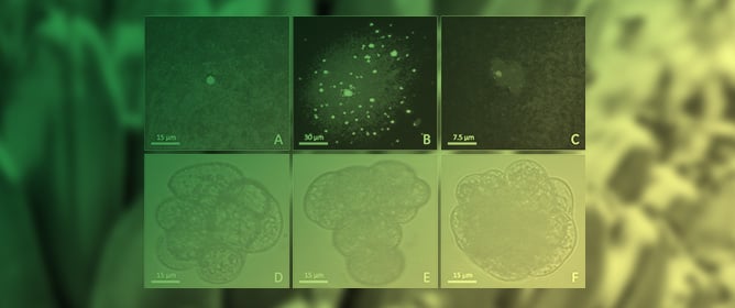 An Improved Approach to Protoplast Regeneration and Transfection in Banana (<em>Musa acuminata</em> AAA cv. Williams)