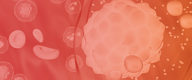 Role of Daratumumab, Lenalidomide, and Dexamethasone in Transplantation-Eligible Patients with Multiple Myeloma After the Failure of Bortezomib-Based Induction Therapy <sup>&dagger;</sup>