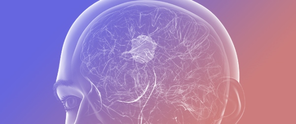 Artificial Intelligence in Glioma Diagnosis: A Narrative Review of Radiomics and Deep Learning for Tumor Classification and Molecular Profiling Across Positron Emission Tomography and Magnetic Resonance Imaging