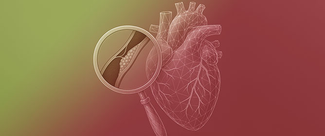 Machine Learning Application in Different Imaging Modalities for Detection of Obstructive Coronary Artery Disease and Outcome Prediction: A Systematic Review and Meta-Analysis