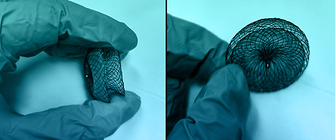 The Congenital Malformation of the Interatrial Septum&mdash;A Review of Its Development and Embryology with Clinical Implications