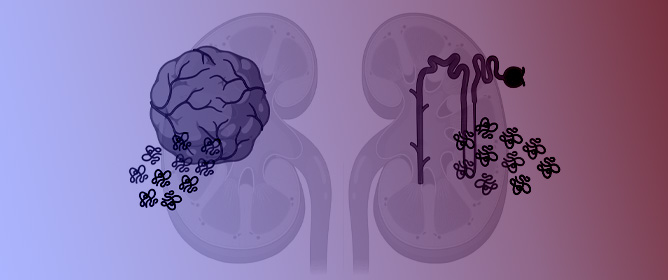 Combining Proteomics and Organoid Research to Unravel the Multifunctional Complexity of Kidney Physiology Enhances the Need for Controlled Organoid Maturation