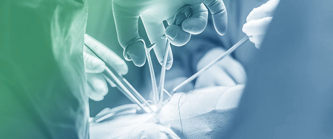 Cardiac Surgery and Postoperative Atrial Fibrillation: The Role of Cancer