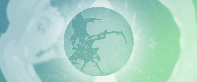 The Unnoticed Threat: Clinical Characteristics, Risk Factors, and Outcome of Mucormycosis in Solid Organ Transplantation