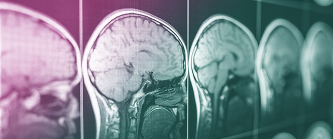 Traumatic Brain Injury: Advances in Diagnostic Techniques and Treatment Modalities